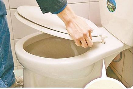 智能马桶盖
